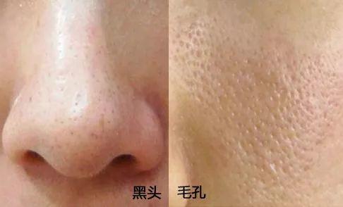 做好这一步,1分钟养成零毛孔鸡蛋肌! 做好这一步,1分钟养成零毛孔鸡蛋肌!