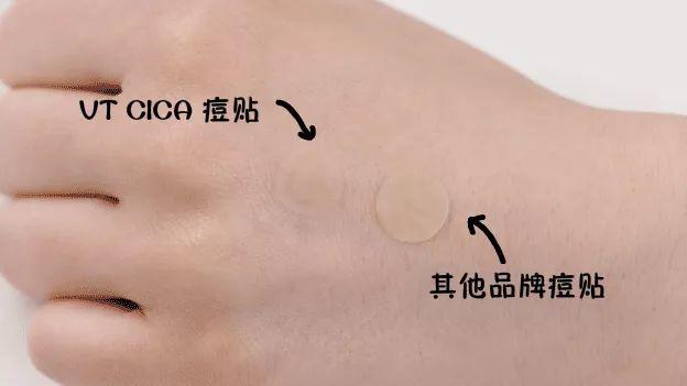 这些相见恨晚的祛痘产品,让你再也没有长痘烦恼! 这些相见恨晚的祛痘产品,让你再也没有长痘烦恼!