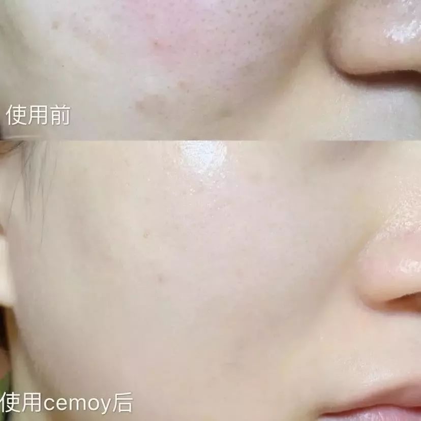 澳洲cemoy21天极光晚安精华液，李佳琦推荐的减龄秘诀  第4张