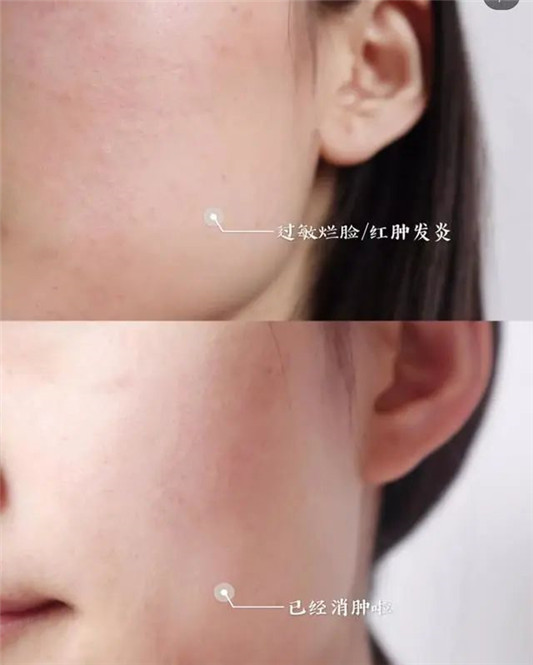 适合敏感肌夏天使用的艾珂薇N4面霜，仅仅只是清爽那么简答吗？  面霜 第13张