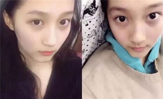 五官再精致的女生，眼睛有这3个“缺点”照样拉低颜值，你有吗？  黑眼圈 第3张