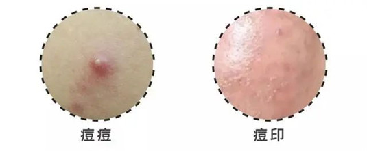 20岁到40岁面部精华推荐 精华 20岁 40岁 种草 护肤 第3张 20岁到40岁面部精华推荐 精华 20岁 40岁 种草 护肤 第3张