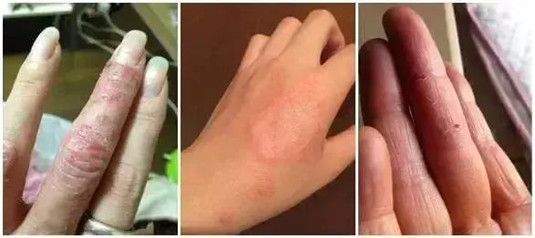 还在羡慕别人的小嫩手，这一瓶养出志林姐姐同款小嫩手，白菜价哦  护手霜 双手 山羊 第3张