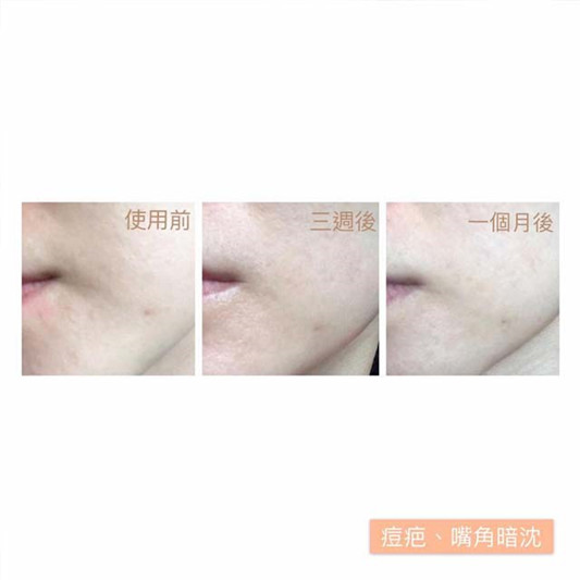 VICHY薇姿15%维生素C超导安瓶使用心得，肤色不均及嘴角暗沉有改善  超导 不均 第3张