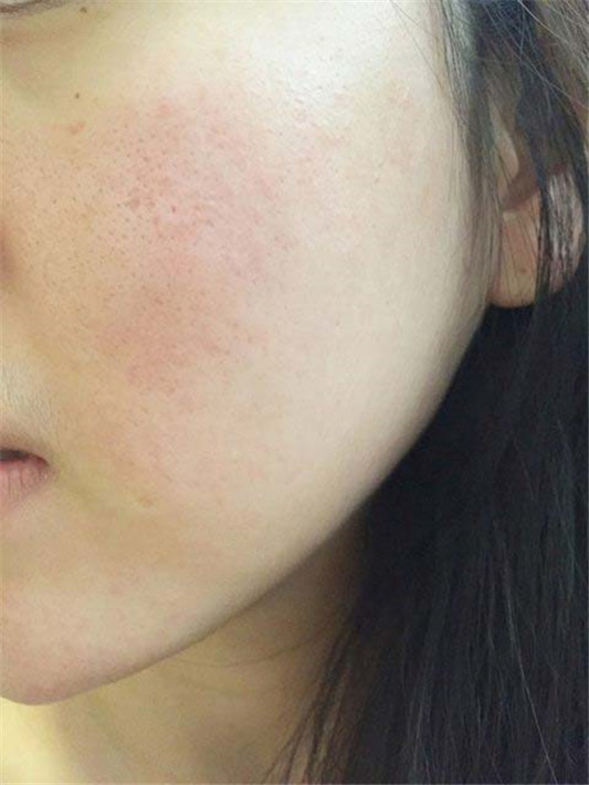 敏感混合蜜糖DARPHIN小粉红全效舒缓精华使用心得  蜜糖 舒缓 第2张