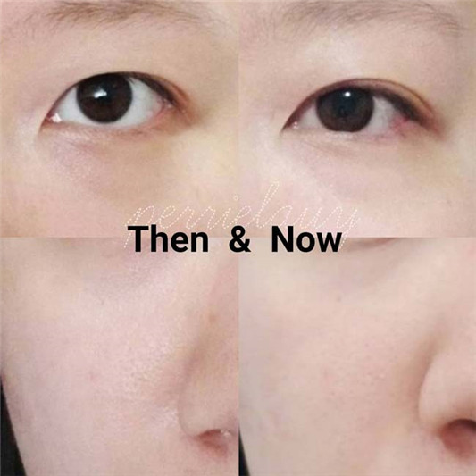 详细点评 The Ordinary Skincare