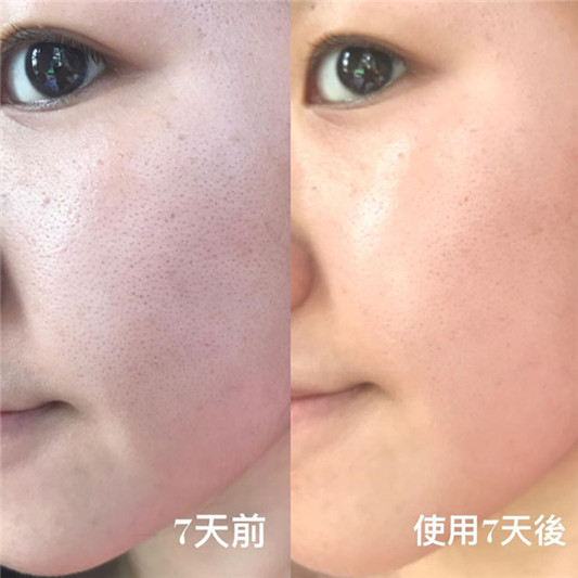 科颜氏维生素c紧肤精华乳液使用心得，附7天试用前后对比