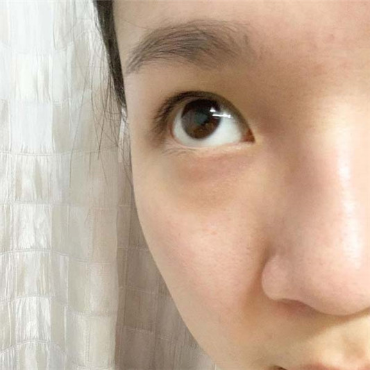 VICHY薇姿M89微精华眼霜怎么样，是一款非常清爽的眼部护理产品  眼部 眼霜 第3张