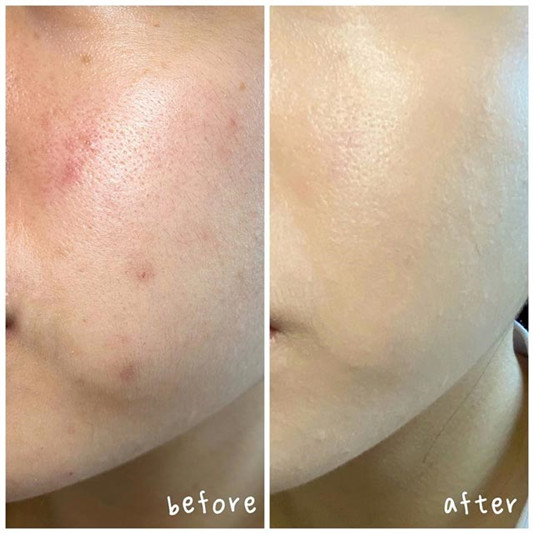 Charlotte Tilbury Airbrush Flawless粉底液2 Neutral色号试色分享 彩妆 粉底液 分享 第2张 Charlotte Tilbury Airbrush Flawless粉底液2 Neutral色号试色分享 彩妆 粉底液 分享 第2张