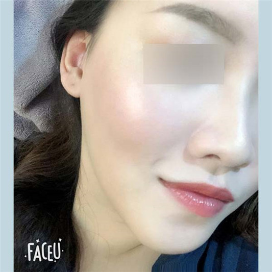 Charlotte Tilbury**面部盘lightga**试色,与nars腮红叠擦超美 彩妆 腮红 面部 ** 第4张 Charlotte Tilbury**面部盘lightga**试色,与nars腮红叠擦超美 彩妆 腮红 面部 ** 第4张