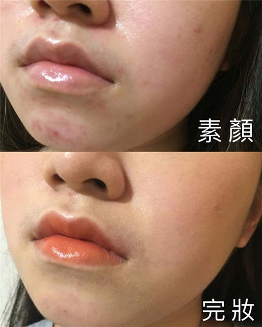 Wet n Wild超平价粉底棒试色,好强的遮瑕力 彩妆 粉底 好强 平价 第4张 Wet n Wild超平价粉底棒试色,好强的遮瑕力 彩妆 粉底 好强 平价 第4张