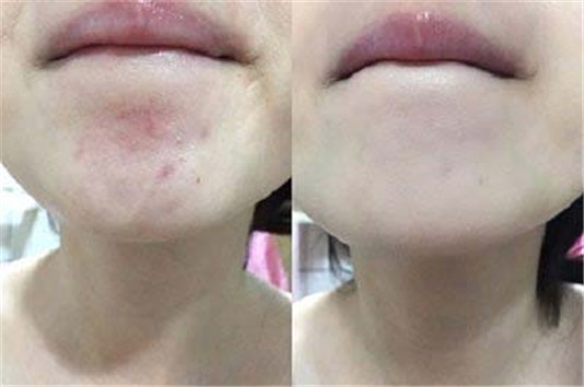 YSL恒久完美无瑕粉底使用心得,遮瑕满意雀斑不见 彩妆 完美无瑕 雀斑 粉底 第3张 YSL恒久完美无瑕粉底使用心得,遮瑕满意雀斑不见 彩妆 完美无瑕 雀斑 粉底 第3张