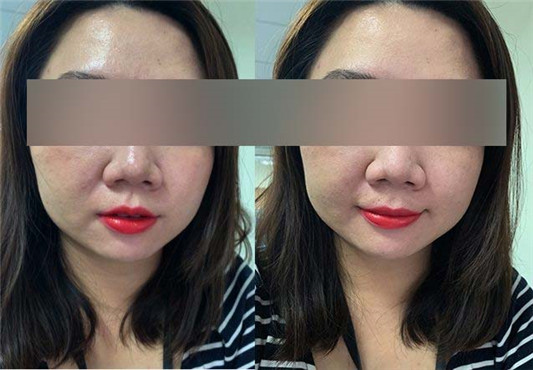 Za油光bye2特效控油液,油肌补妆实测 彩妆 油光 实测 控油 第3张 Za油光bye2特效控油液,油肌补妆实测 彩妆 油光 实测 控油 第3张