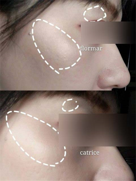 新手打亮分享catrice&flormar  E Catrice 分享 第5张