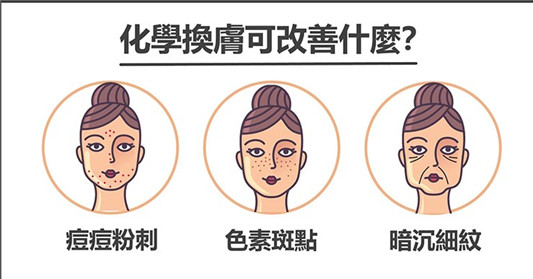 化学换肤,果酸焕肤,原来还有这些学问! 百科 果酸 学问 换肤 第2张 化学换肤,果酸焕肤,原来还有这些学问! 百科 果酸 学问 换肤 第2张