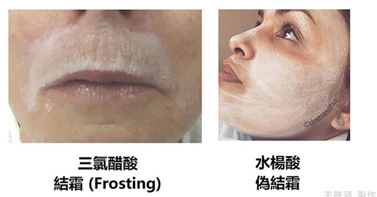 化学换肤,果酸焕肤,原来还有这些学问! 百科 果酸 学问 换肤 第7张 化学换肤,果酸焕肤,原来还有这些学问! 百科 果酸 学问 换肤 第7张