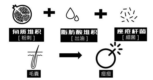 都快三十岁了还长痘痘，是内分泌失调吗，