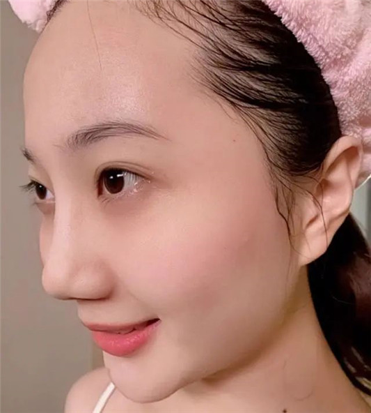 皮肤粗糙暗沉？注意睡前的四个护肤小技巧，皮肤越变越好  面膜 第3张
