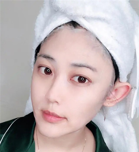皮肤粗糙暗沉？注意睡前的四个护肤小技巧，皮肤越变越好  面膜 第6张
