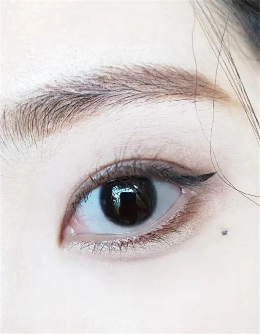 为什么18岁以上要用眼霜，只因为我的“比你贵”吗？这样想就错了  眼部 第6张