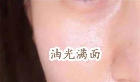 毛孔粗大、黑头、闭口咋办？3招细成蛋白肌  毛孔 第13张