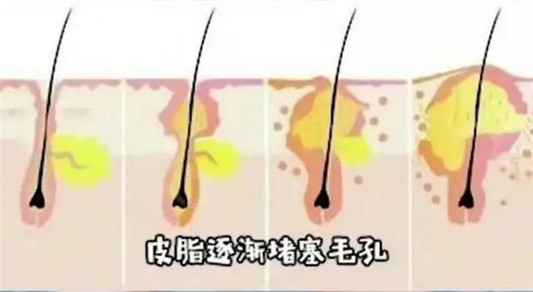 你需要了解的洗脸的重要知识！谈谈目前火爆的两款氨基酸洗面奶  洗面奶 第2张