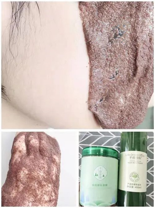 快来康康这八款面膜，爆痘期的救命草，搞它  面膜 第8张
