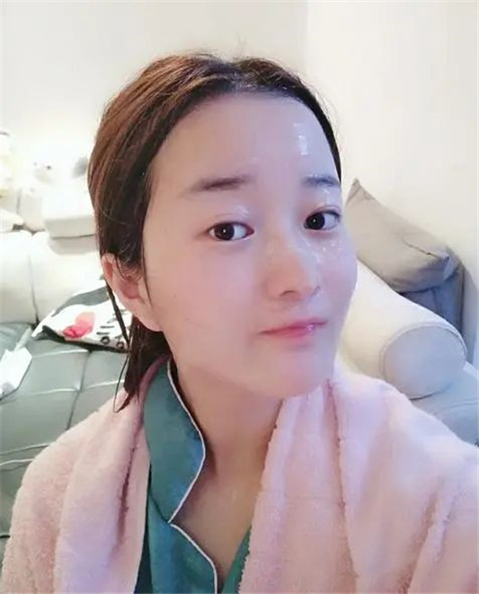 芦荟胶4个不为人知的“功效”，可以做补水面膜，还能祛痘消炎  芦荟胶 第7张