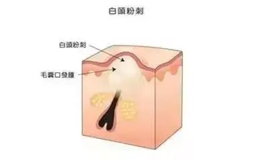 如果你第一次入手日本药妆，我强烈建议你买这个品牌！  肌肤 第5张