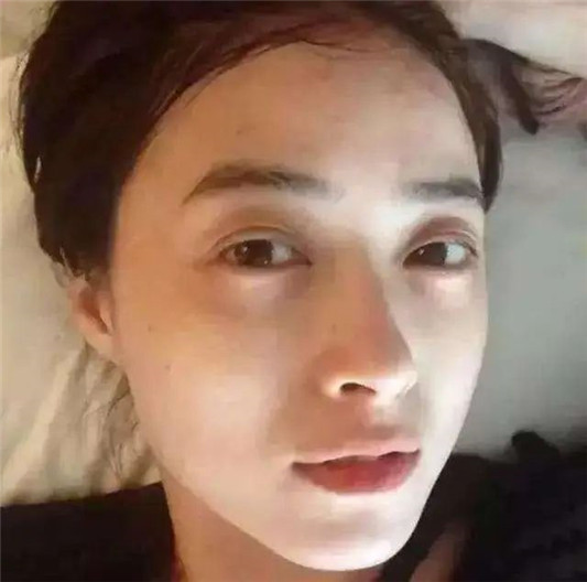容易让皮肤变差的4种错误做法，据说很多人都在犯，难怪皮肤差！  皮肤 第5张