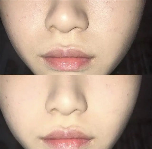 夏天拒绝油腻，5款适合油皮、混油皮的控油散粉测评  如有 第7张