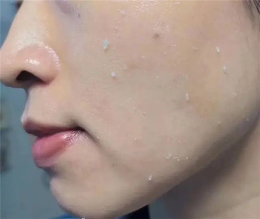 护肤品一用就搓泥 这几个原因是关键，难怪上千元贵妇精华都中招