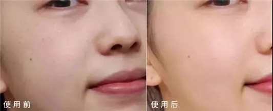 东星祛斑霜效果怎么样，东星祛斑霜使用多久才有效果  祛斑 东星祛斑霜效果怎么样 东星祛斑霜使用多久才有效果 第6张
