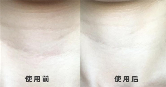 COCO AMELIA颈霜烟酰胺淡化颈纹颈霜怎么样，使用心得及优缺点分享  AMELIA 颈纹 颈纹霜 颈霜 第2张