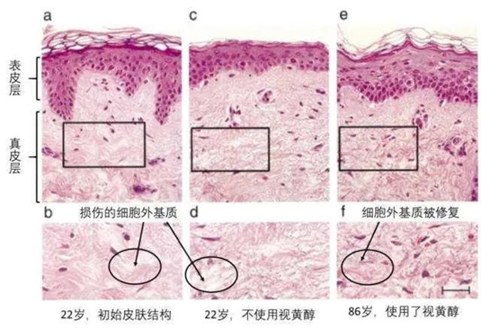 「早C晚A」这样护肤真的靠谱吗 是的 这样非常靠谱还很有效  还很 护肤 第3张