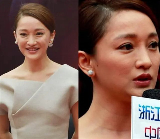 眼睛这4个「缺点」最影响颜值，化妆也很难掩盖，我中了1个，你呢  很难 中了 第3张