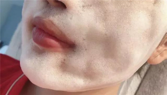 网红泡泡面膜真的能用出白皮肤 脸越脏泡泡越多是来搞笑的  泡泡 越多 第4张