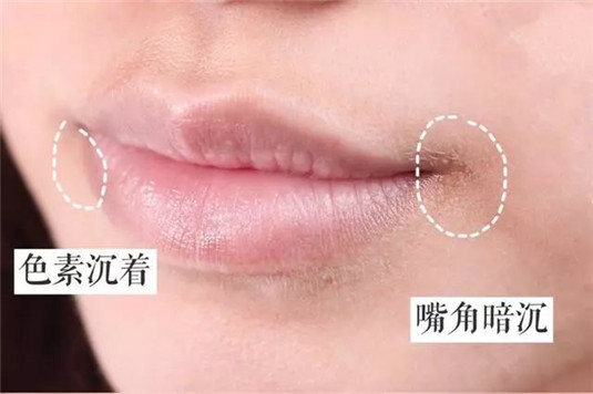 让唇部越来越丑的5个坏习惯，有的话就「戒掉」吧  唇部 戒掉 第3张
