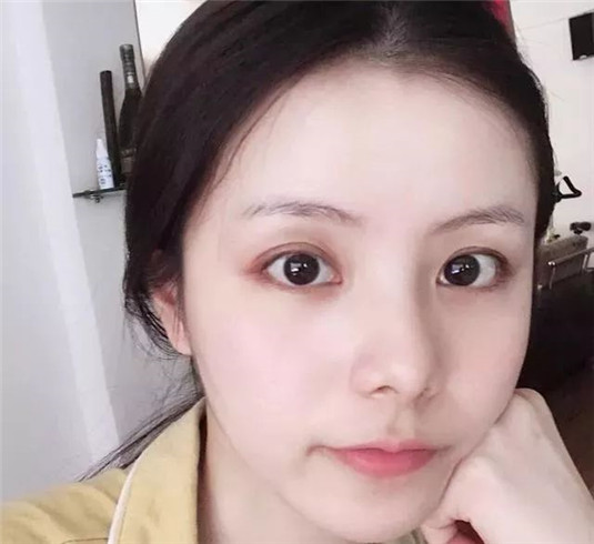 好皮肤是「养」出来的 能做到这4点的女孩子，通常皮肤都不会差  皮肤 能做到 第5张