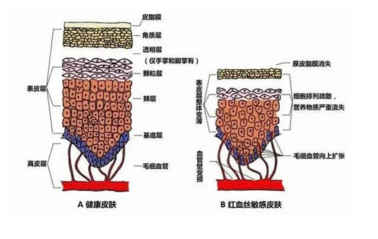 自带高原红 良心分享，教你修复红血丝