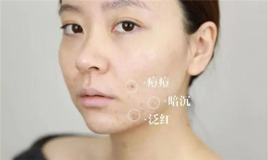 30岁女人精华面霜选择，四款王牌精华推荐