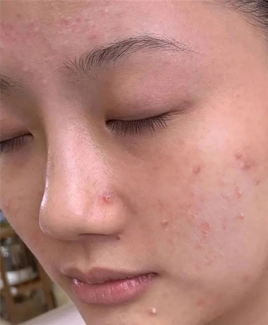 日本最火的护肤方法，「肌断食」，是「冻龄女神」的必修课  日本 必修课 第5张