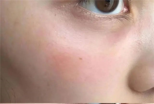 护肤第一步要端正理念，掌握这些小细节才能修复肌肤屏障  屏障 护肤 第2张