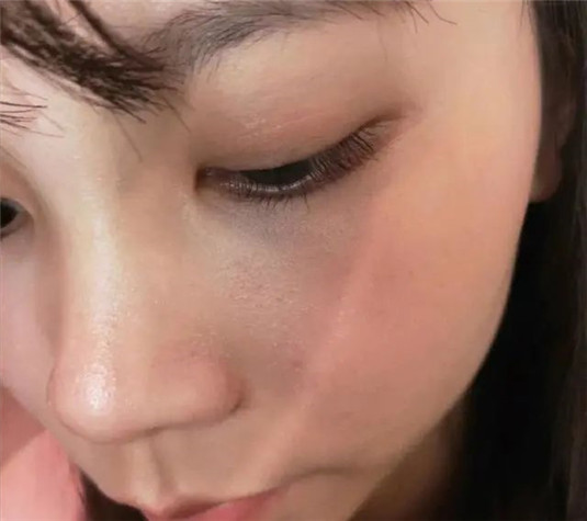 护肤第一步要端正理念，掌握这些小细节才能修复肌肤屏障  屏障 护肤 第4张