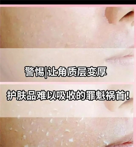 护肤第一步要端正理念，掌握这些小细节才能修复肌肤屏障  屏障 护肤 第9张