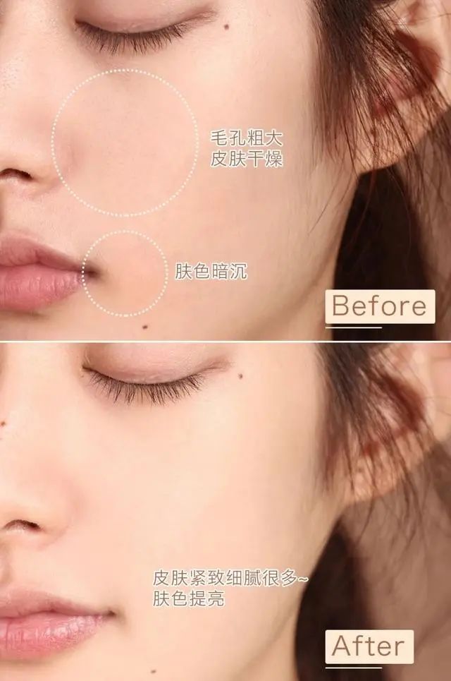 25岁初级抗衰老水乳推荐，皮肤滋润有光泽  水乳 抗衰老 25岁 第6张