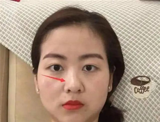 公认的女生“丑鼻型”4个特点，脸型再美也难拯救，希望你没中  鼻梁 鼻子 都是 第5张