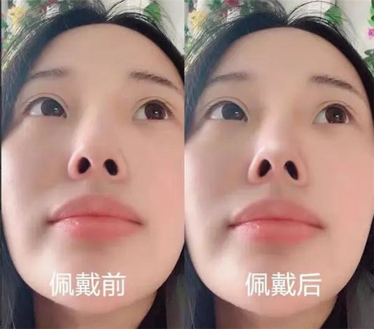 这些护肤骗局，你还不知道难怪花钱又烂脸，快康康你有没有中招  面膜 隆鼻 肌肤 第5张