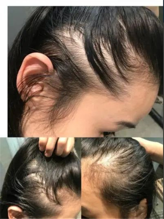 这些护肤骗局，你还不知道难怪花钱又烂脸，快康康你有没有中招  面膜 隆鼻 肌肤 第11张