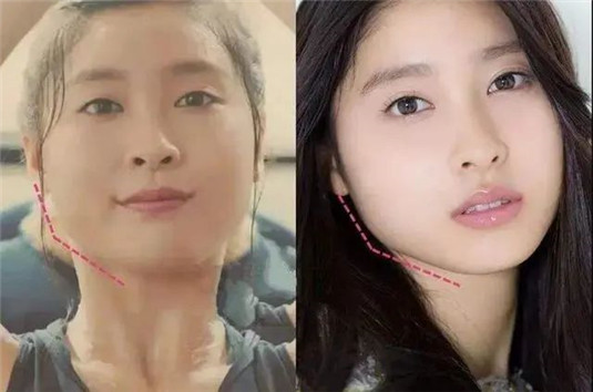 为什么有人年纪轻轻却非常显老这三个原因是关键，希望你没有，  皮肤 自己的 穿衣 第2张